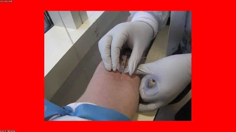 Dấu hiệu nhận biết suy giảm nội tiết tố nam theo tuổi tác